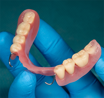 Dentist holding a partial denture