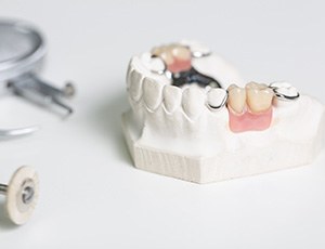 a partial denture on a plaster mold