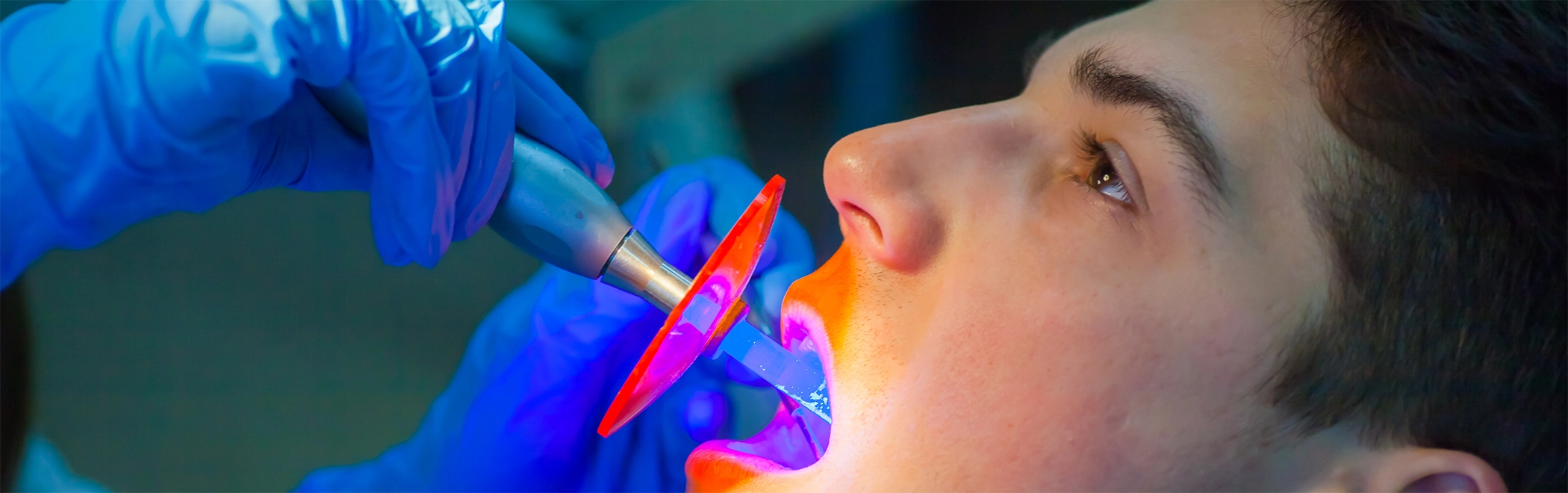Man getting dental bonding treatment from his Richardson dentist