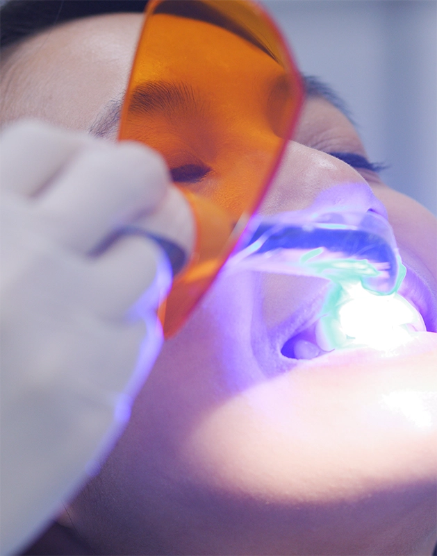 Woman getting dental bonding