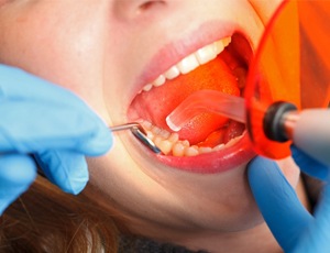 Patient receiving dental bonding treatment