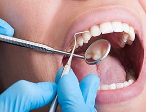 Emergency dentist in Richardson performing an exam