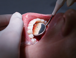 Closeup of smile with healthy teeth and gums after periodontal therapy