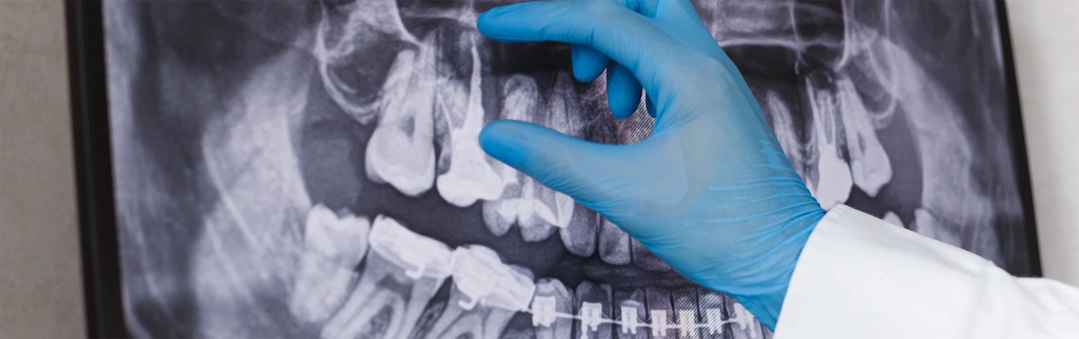 Dentist gesturing to a patient's x-ray of their teeth