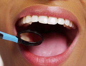 Closeup of patient receiving dental exam after tooth colored filling restoration
