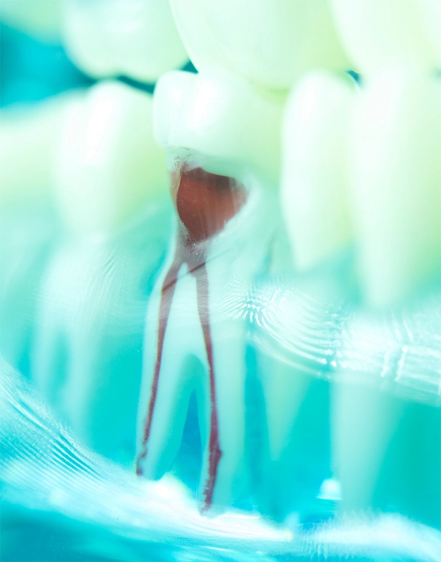 Model of a tooth showing the root canals inside of it
