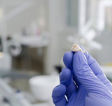Dentist holding an extracted tooth