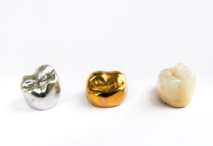 A ceramic, gold and metal dental crown