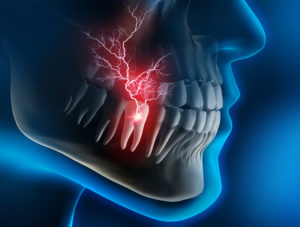 Image showing a painful, infected tooth 