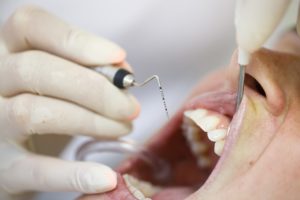 Man having deep cleaning at dentist in Carrollton.