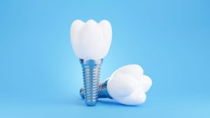 Two dental implants next to each other on a light blue background