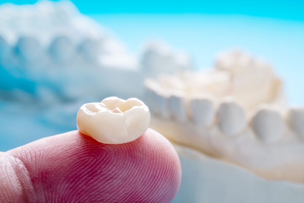 Closeup of a dental crown on a fingertip with model jaw in background
